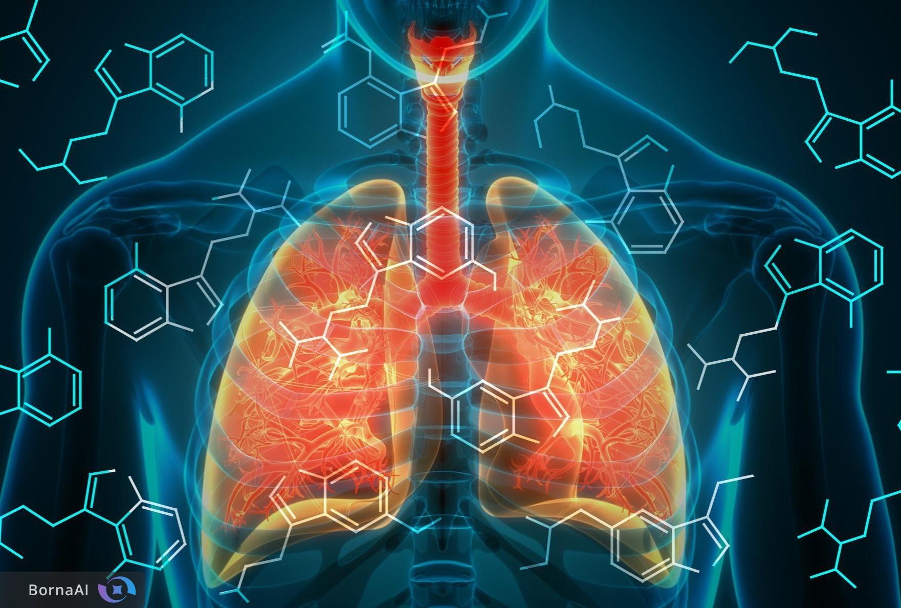 إيران تنضم إلى قائمة منتجي دواء مضاد للتليف الرئوي! إيران تنضم إلى قائمة منتجي دواء مضاد للتليف الرئوي!