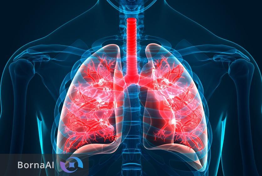 إيران تنضم إلى قائمة منتجي دواء مضاد للتليف الرئوي! إيران تنضم إلى قائمة منتجي دواء مضاد للتليف الرئوي!
