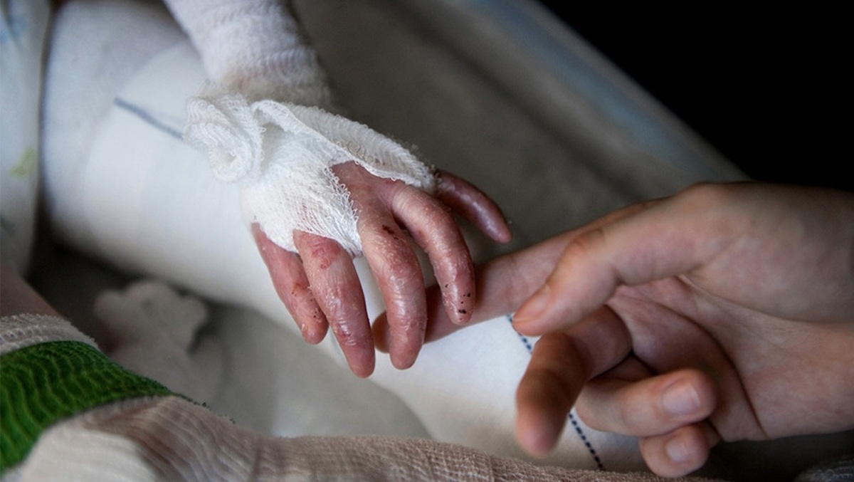 Iran slams ‘cruel, inhumane’ US sanctions against EB patients