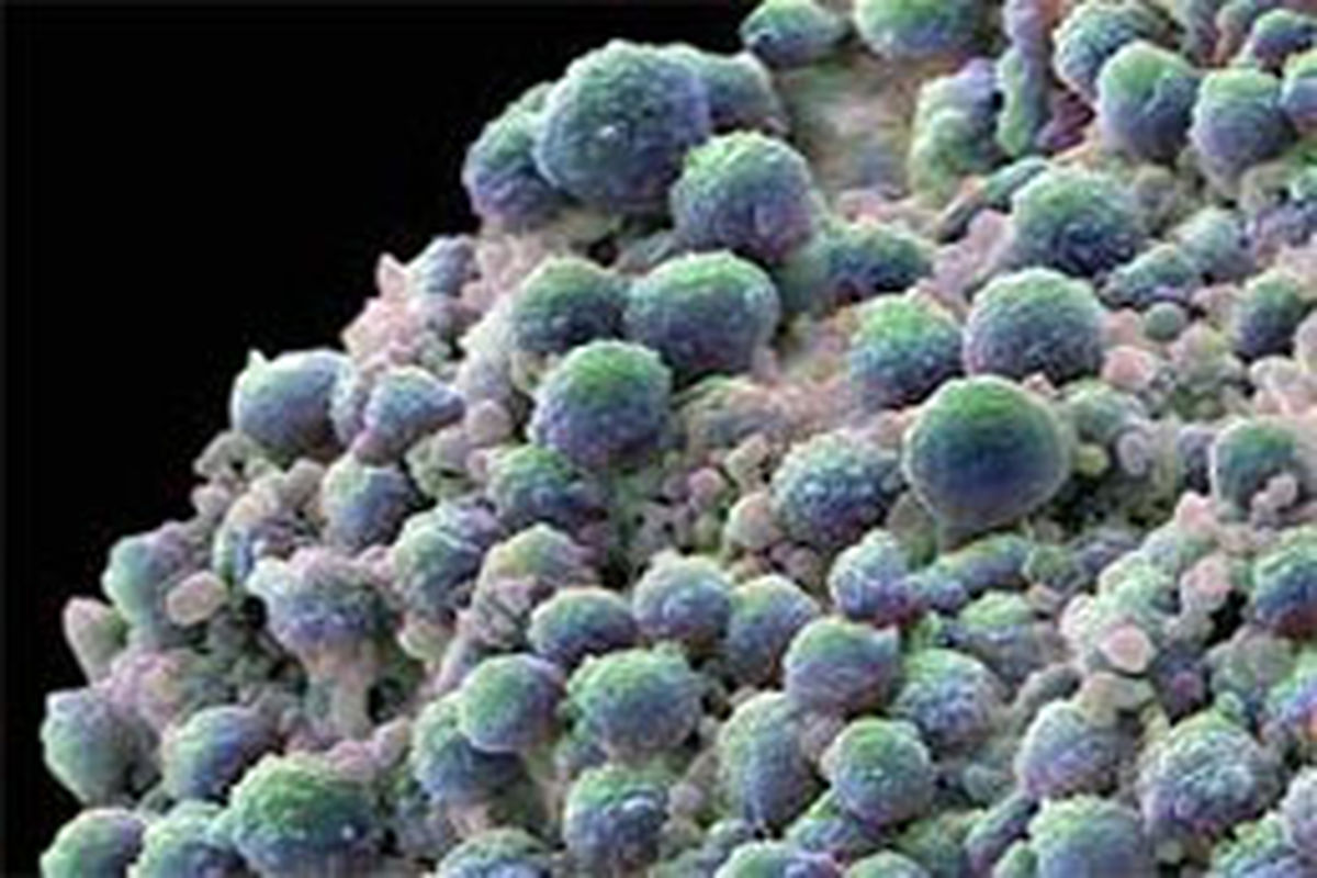 شناسایی زودهنگام سلول‌های سرطانی شناور در خون با تراشه‌ای جدید
