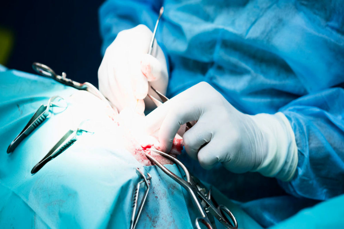 پیوند موفق صورت