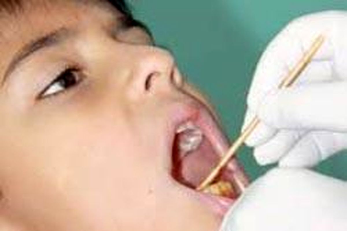 اجرای طرح سلامت دهان و دندان برای ۱۱۰هزار دانش آموز خراسان‌شمالی