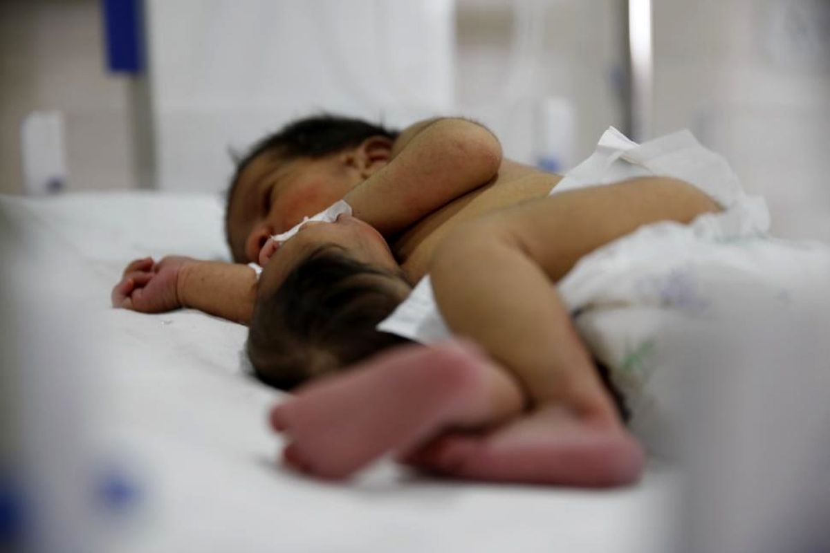 تولد نوزاد با یک سر اضافه روی شکم در بیمارستان میلاد کاشان کذب است