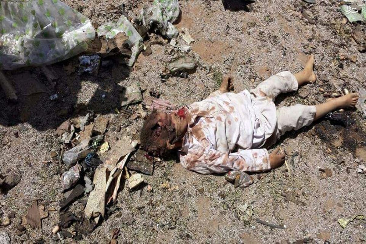 آمار تکان دهنده از تلفات کودکان در جنگ یمن