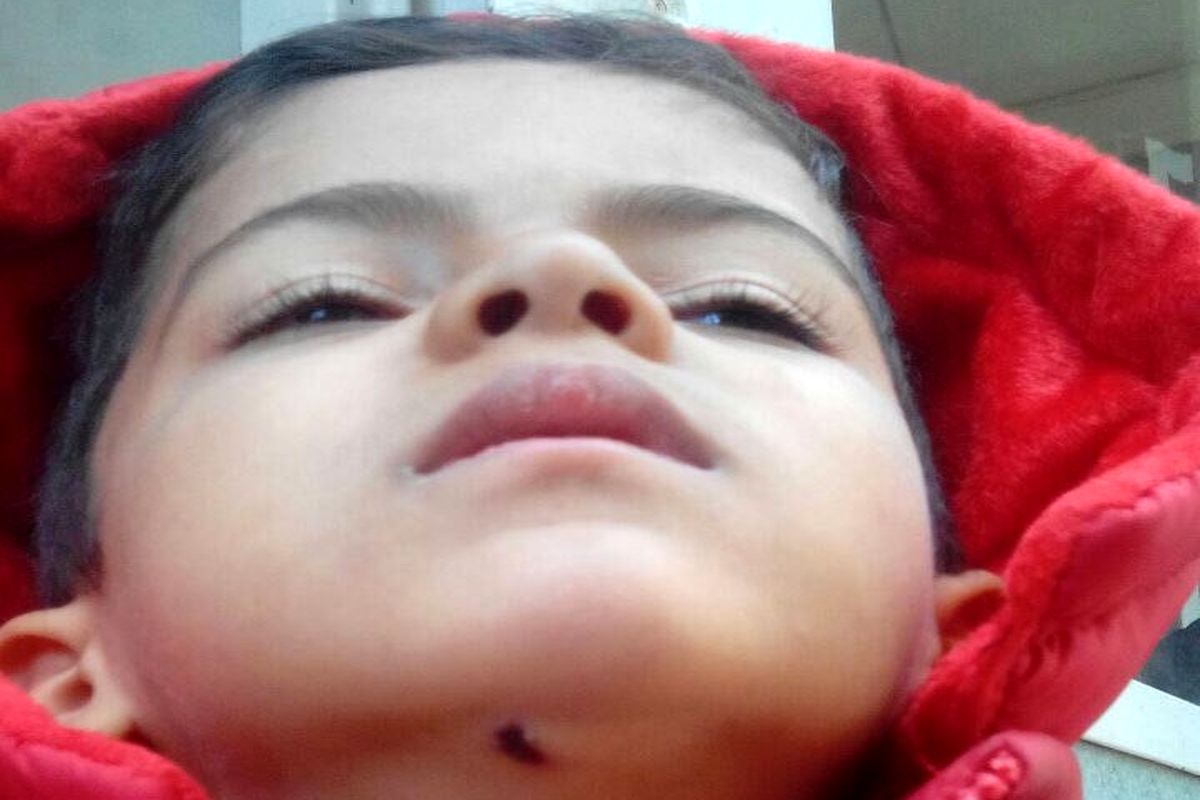 انتشار چهره واقعی کودک ماجرای بیمارستان خمینی شهر/ بزرگ نمایی رسانه ای دروغ از آب درآمد