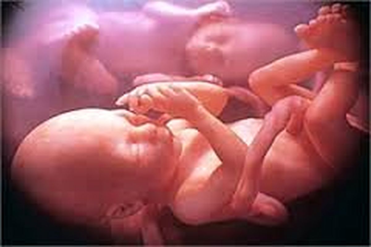 در سقط جنین عملا چه اتفاقی می افتد؟ +۱۸