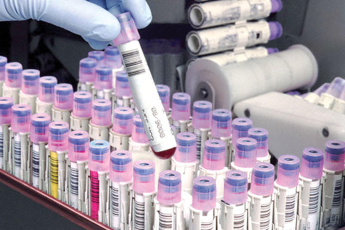 ذخیره بیش از ۸۰ نمونه در بانک خون بندناف جهاددانشگاهی خراسان‌جنوبی