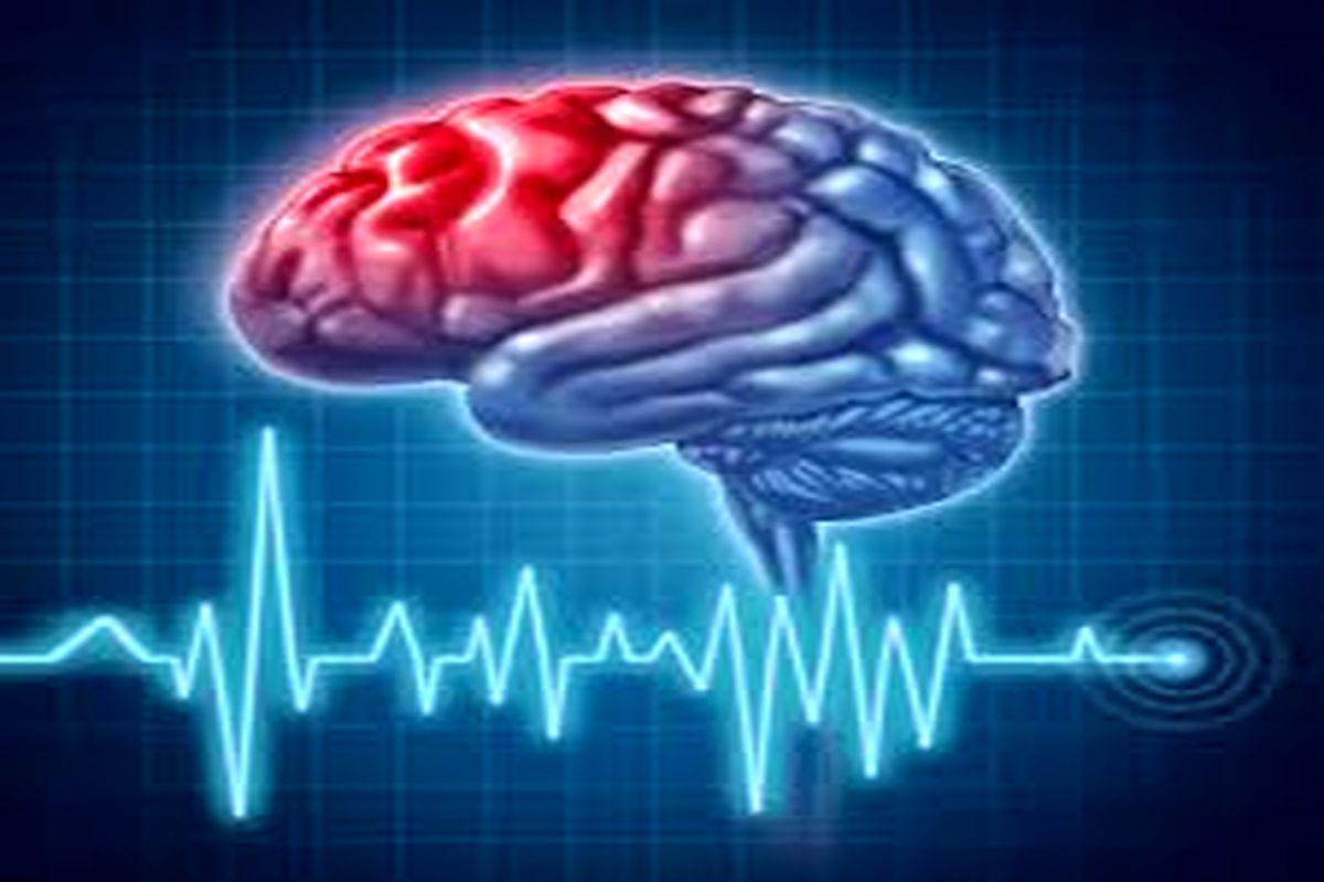 علائم هشداردهنده سکته مغزی چیست؟