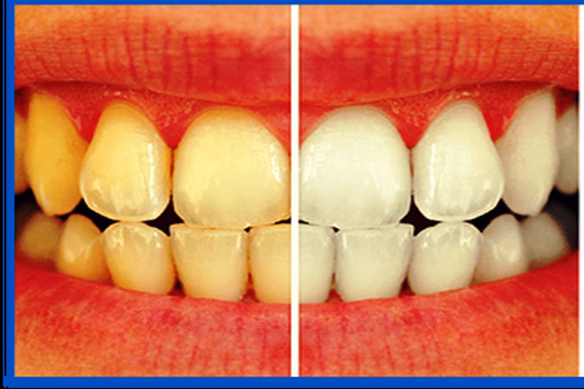سلامتی دهان و دندان مهمترین هدف همه انسان هاست