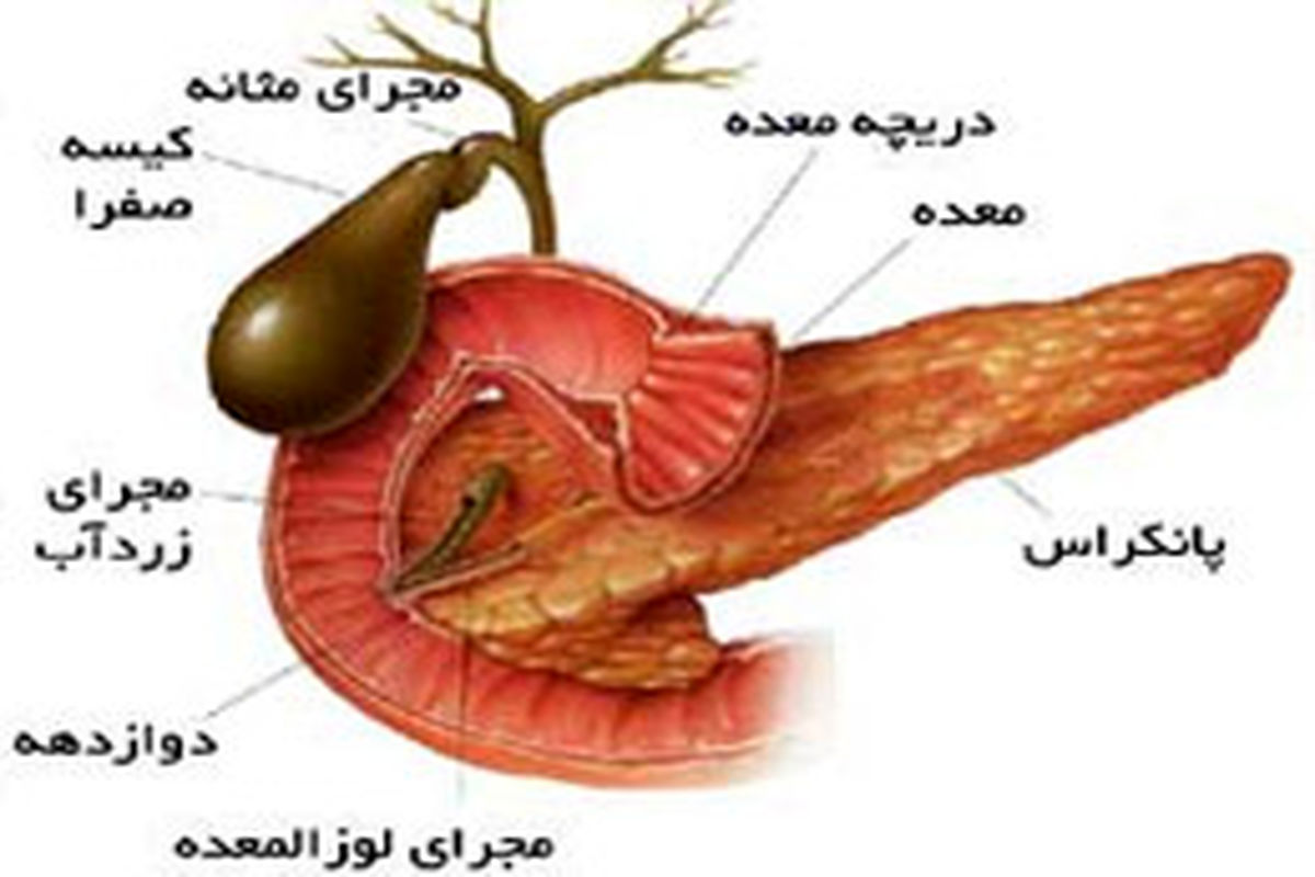 نکات تغذیه ای در مبتلایان به سنگ کیسه صفرا