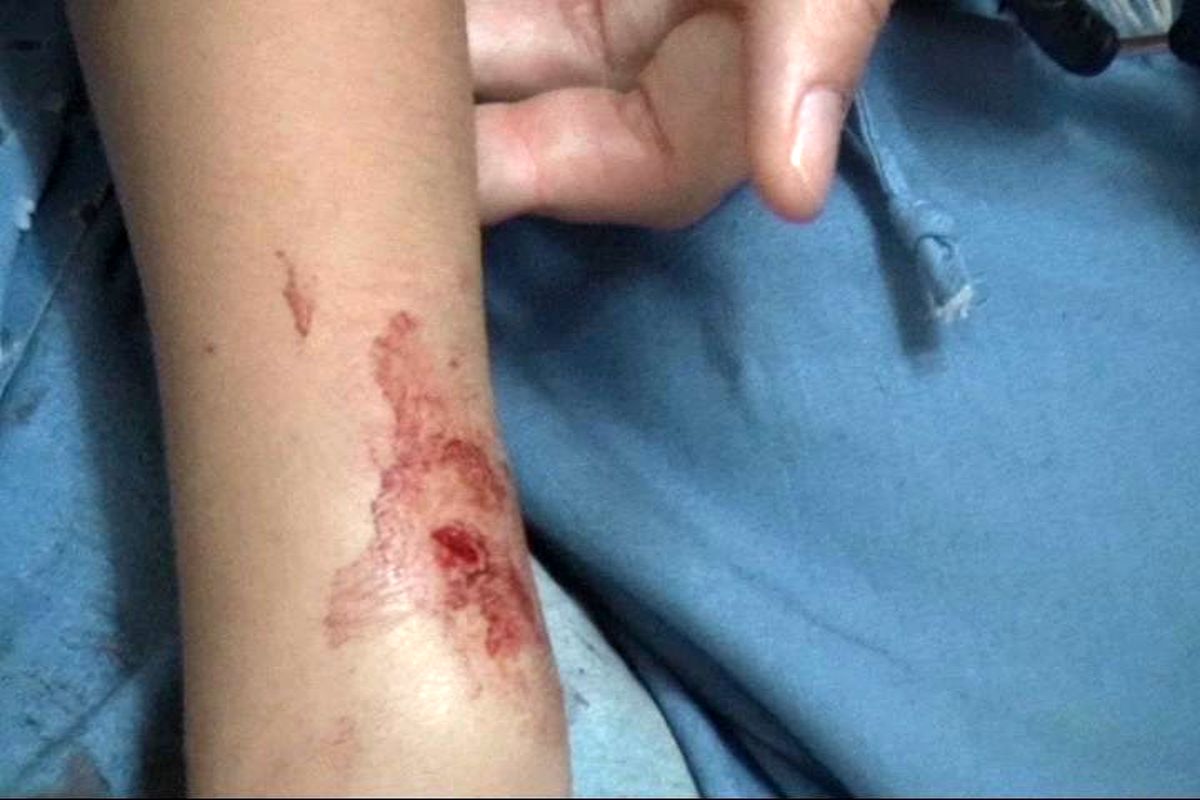 زخمی شدن پنج نفر بر اثر حمله سگ های ولگرد در آستانه اشرفیه