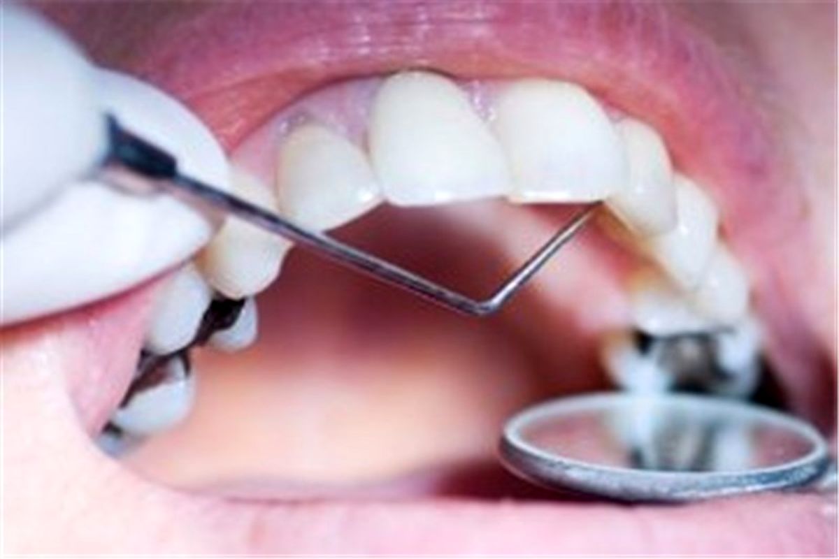 خدمات دندانپزشکی ایران پتانسیل صادرات دارد