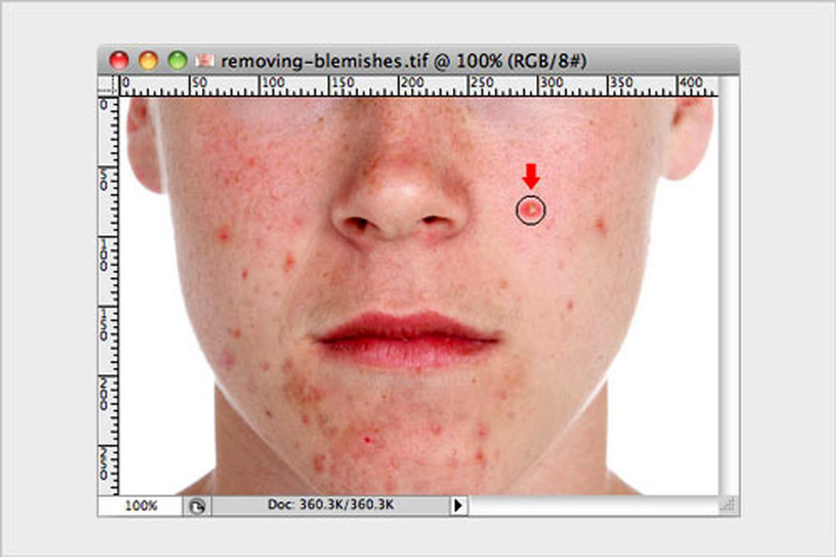 ترمیم جوش‌ها و خال‌های صورت در فتوشاپ