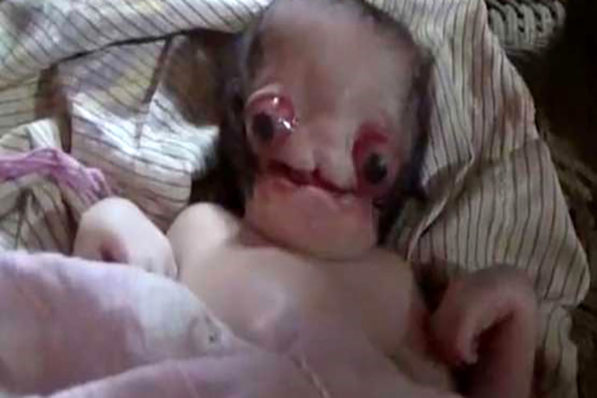 با ترسناک ترین نوزاد جهان آشنا شوید +عکس