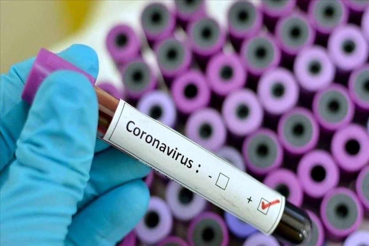 شناسایی یک مورد مثبت کرونا ویروس در آذربایجان غربی