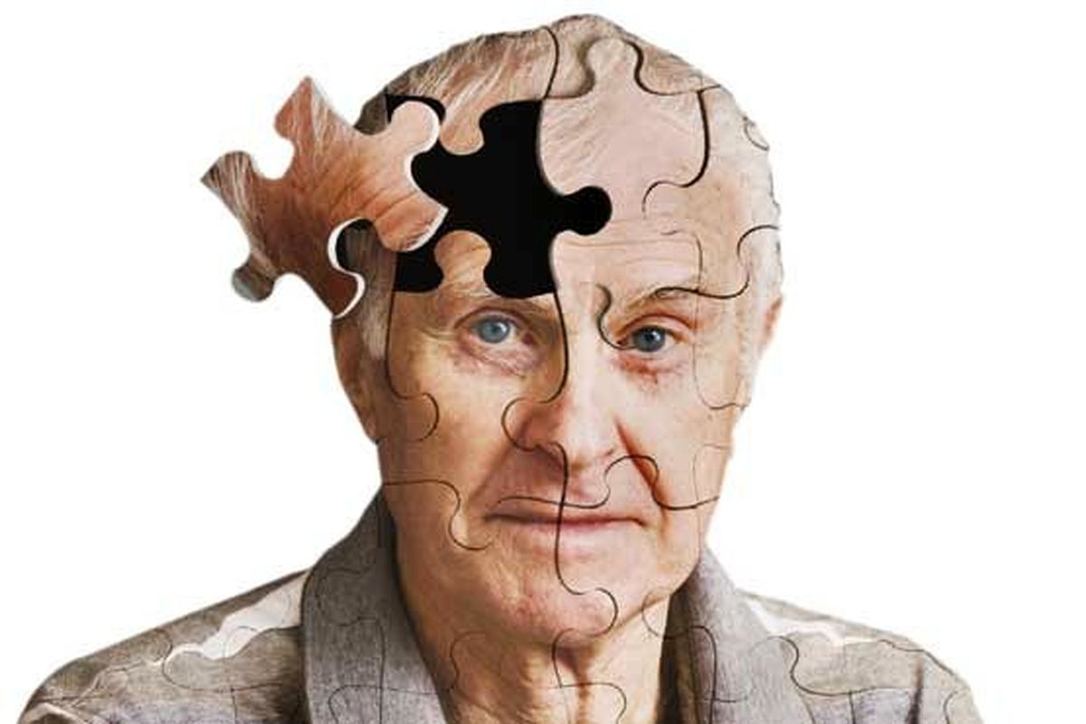 نشانه های پنهان آلزایمر چیست؟