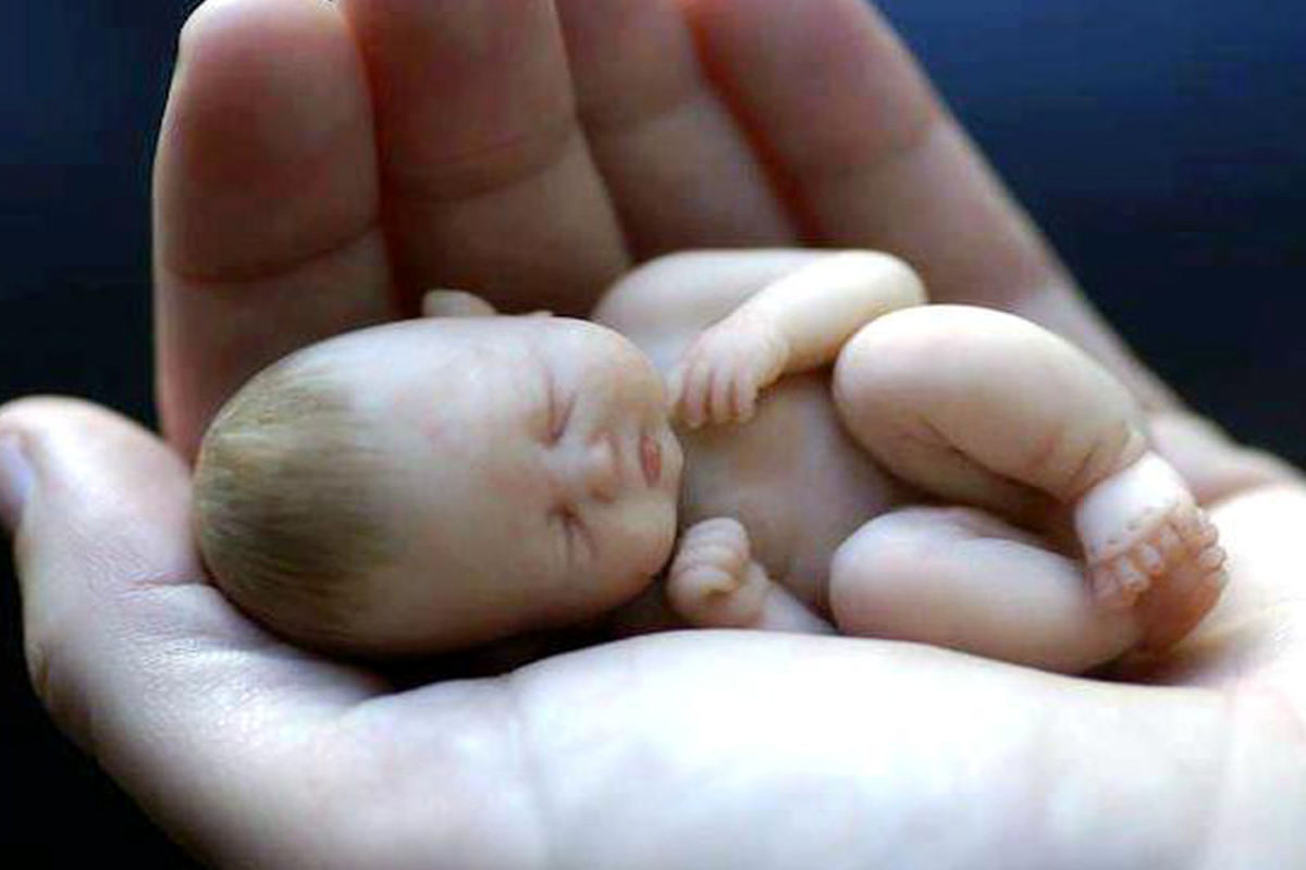 صدور ۲۱۴۹ مجوز سقط درمانی در سه ماهه اول امسال