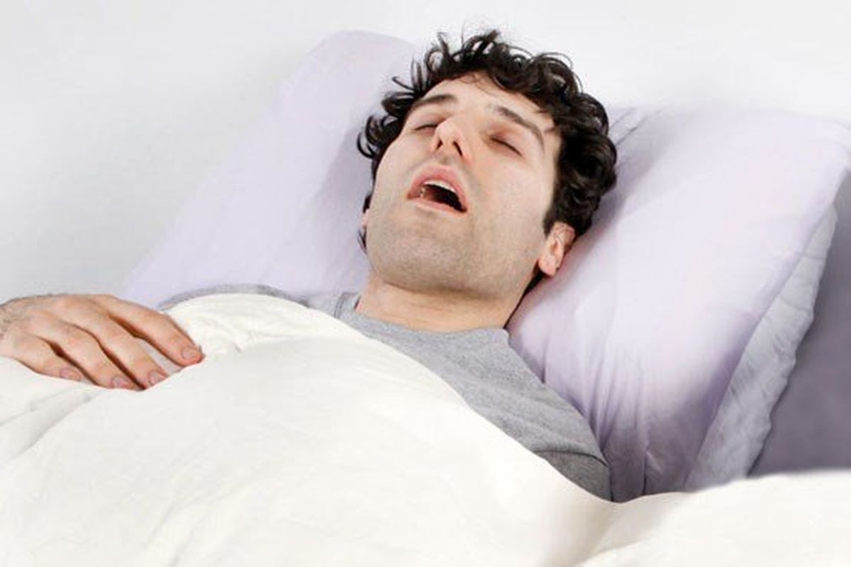 روشی جدید برای درمان آپنه خواب