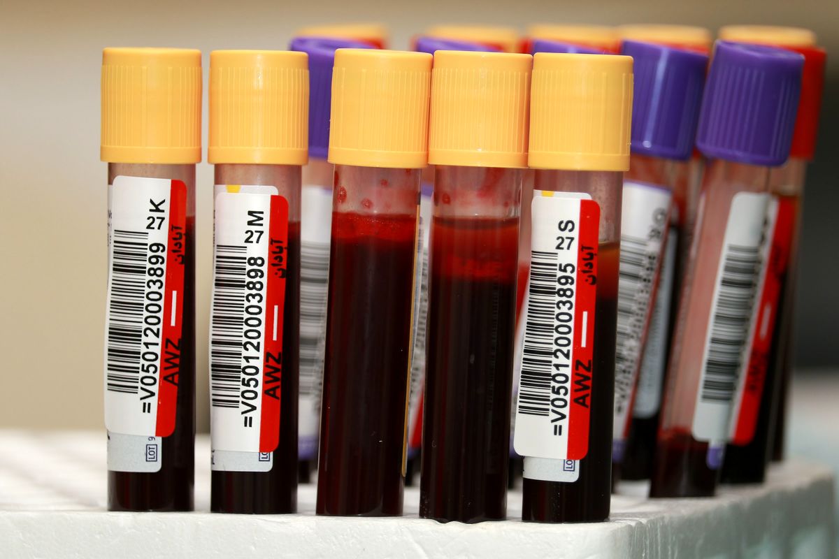 یکی از دلایل اتلاف خون، تجویزهای بی‌رویه است/ صادرات خون به سایر کشورها نداریم