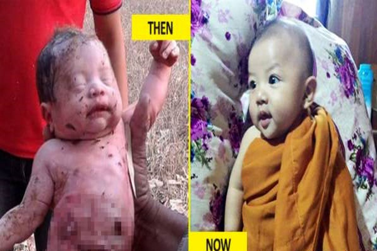زنده به گور شدن نوزاد زخمی توسط مادر بی رحمش+ عکس