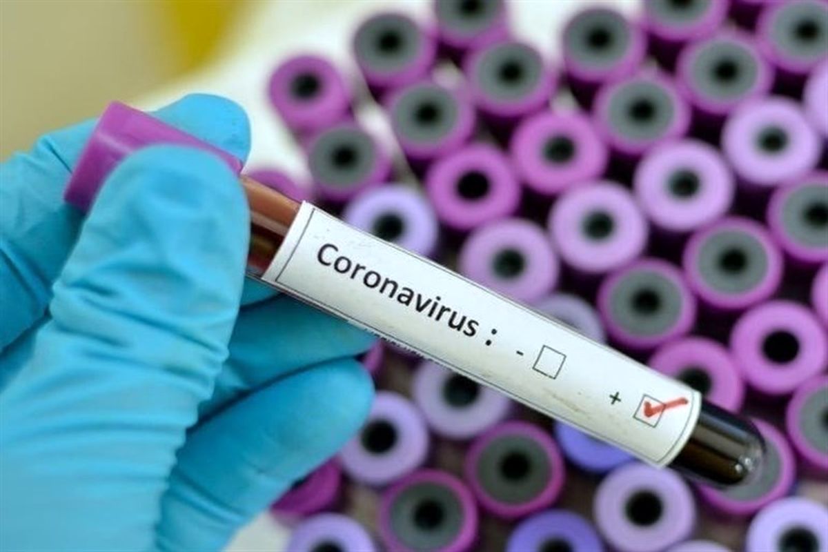مبتلایان به ویروس کرونا تا ۳۰ فروردین ۹۹ در سیستان و بلوچستان به ۴۷۱ نفر رسید