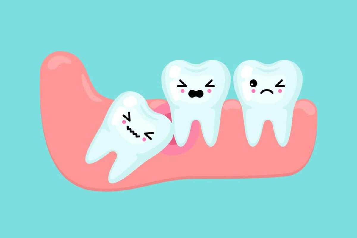 در چه شرایطی می توان دندان عقل را نکشید؟
