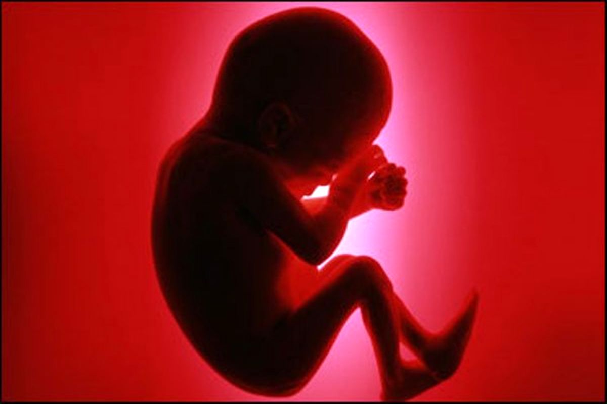قانون سقط درمانی جنین‌های ناهنجار و ناقص‌الخلقه پس از ۱۵ سال نسخ می‌شود/ مجلس جلوی سقط جنین ناقص الخلقه را می گیرد