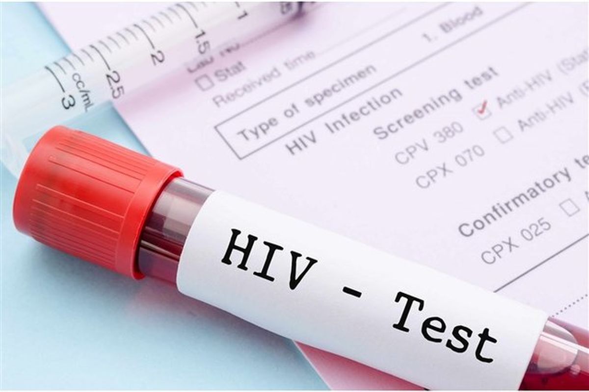 نشانه‌های ابتدایی HIV در زنان