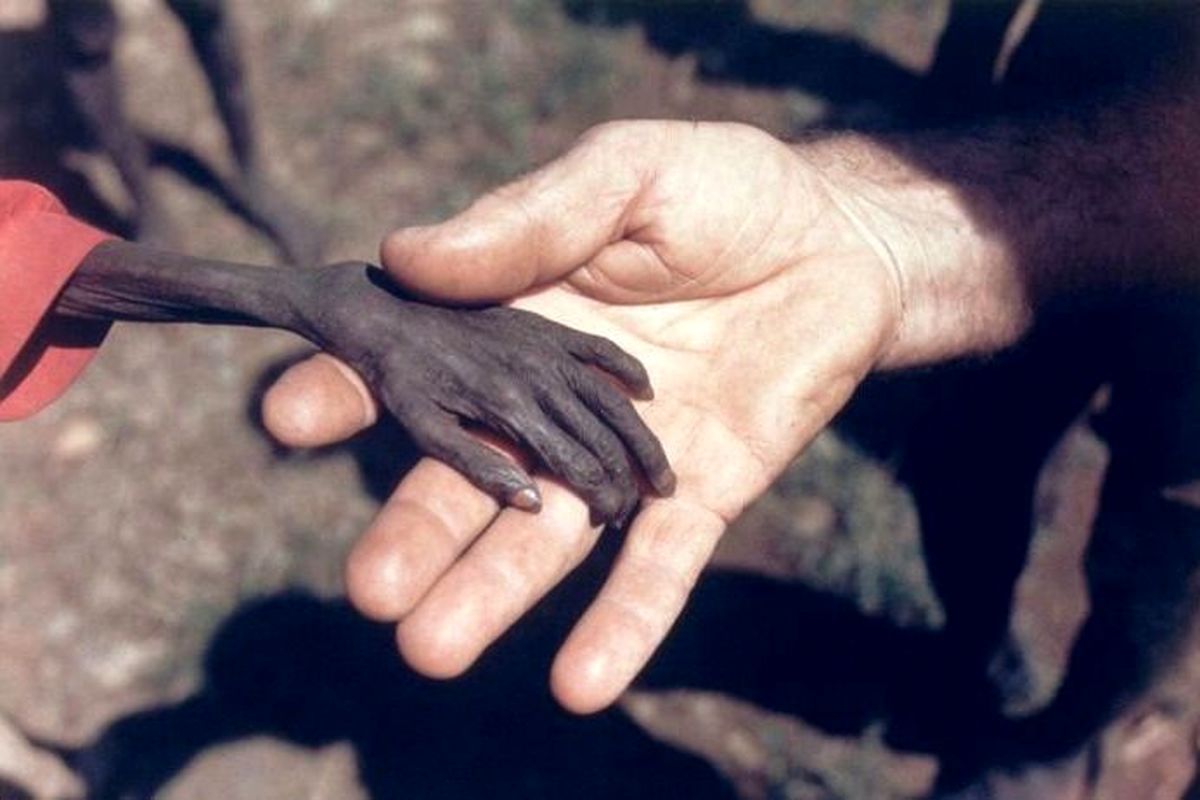 عکس تکان‌دهنده دستان کودک نحیف اوگاندایی در بحران تغذیه آفریقا