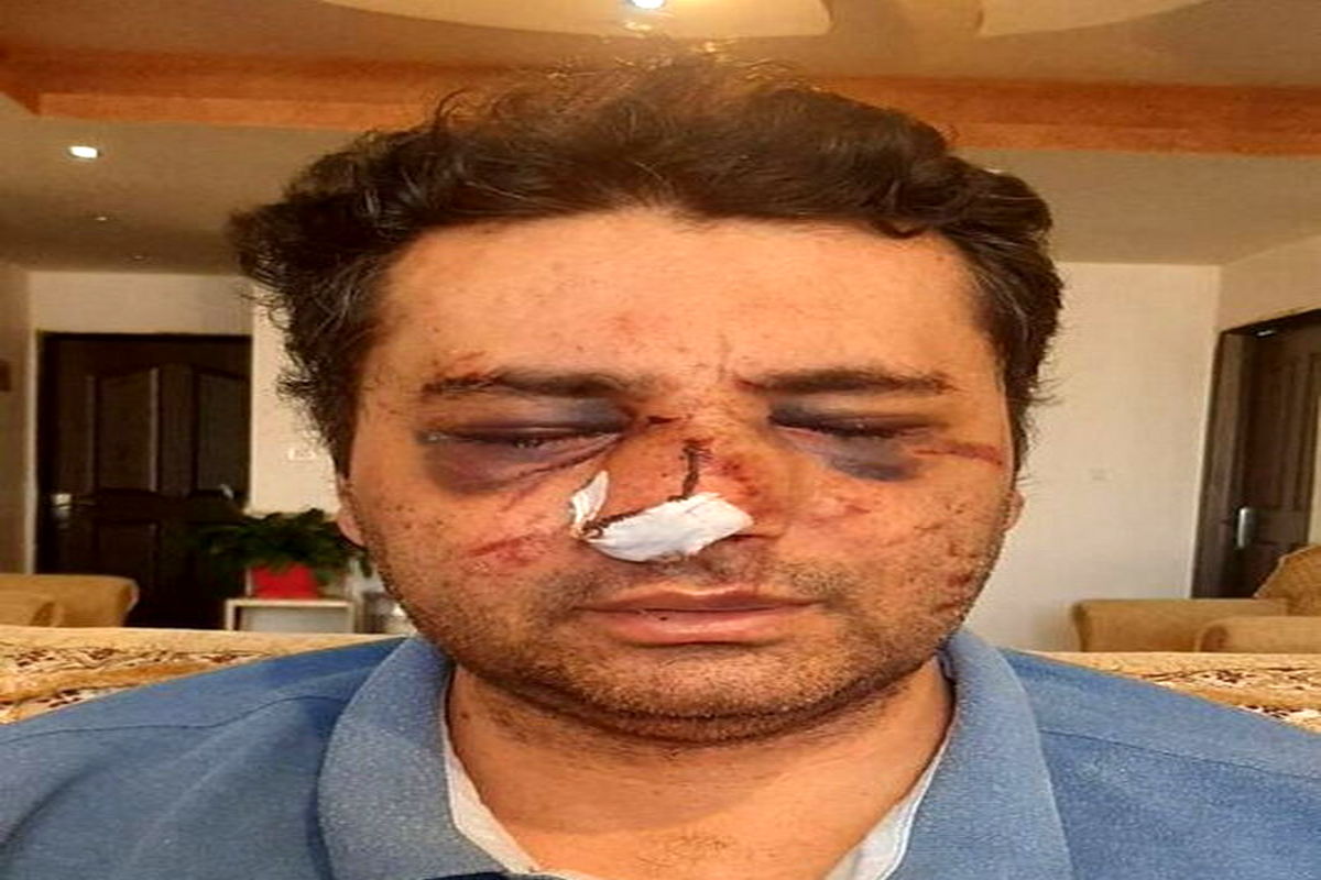 دستور بررسی ماجرای حمله به پزشک پیرانشهری