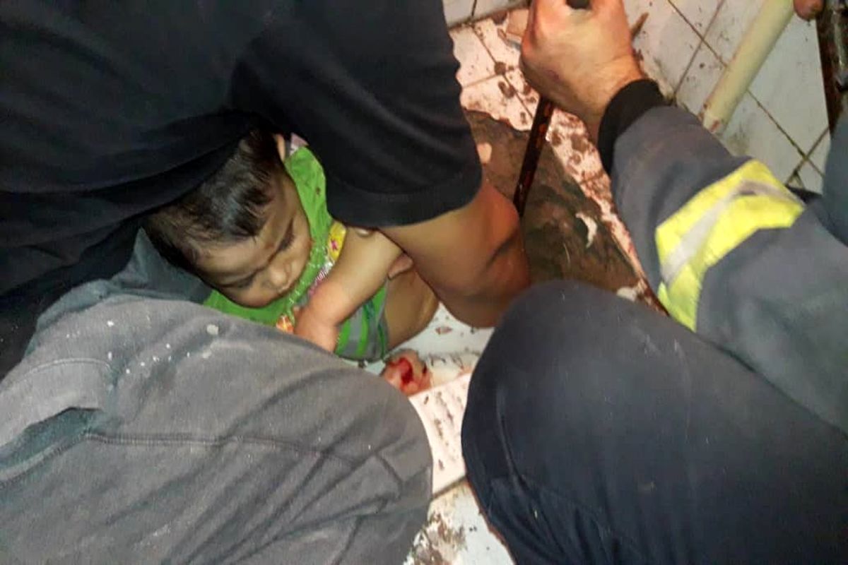پای دختر بچه ۲ ساله از داخل سنگ سرویس بهداشتی رها سازی شد+ببینید