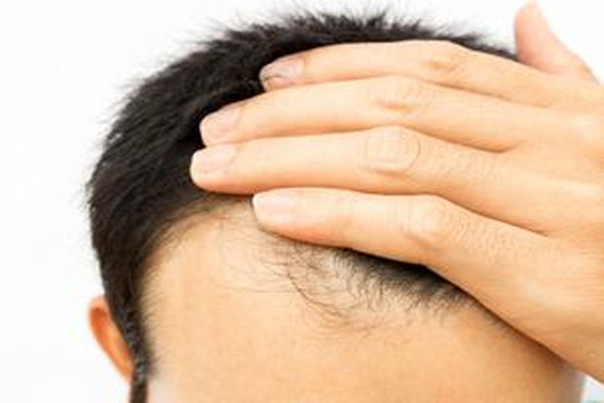 بهترین خوراکی برای جلوگیری از ریزش مو چیست ؟