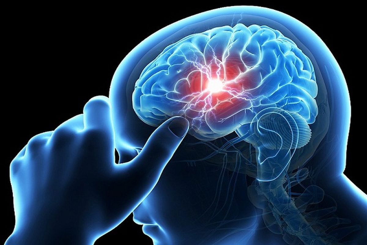 نشانه های سکته مغزی چیست و چگونه پیشگیری کنیم؟