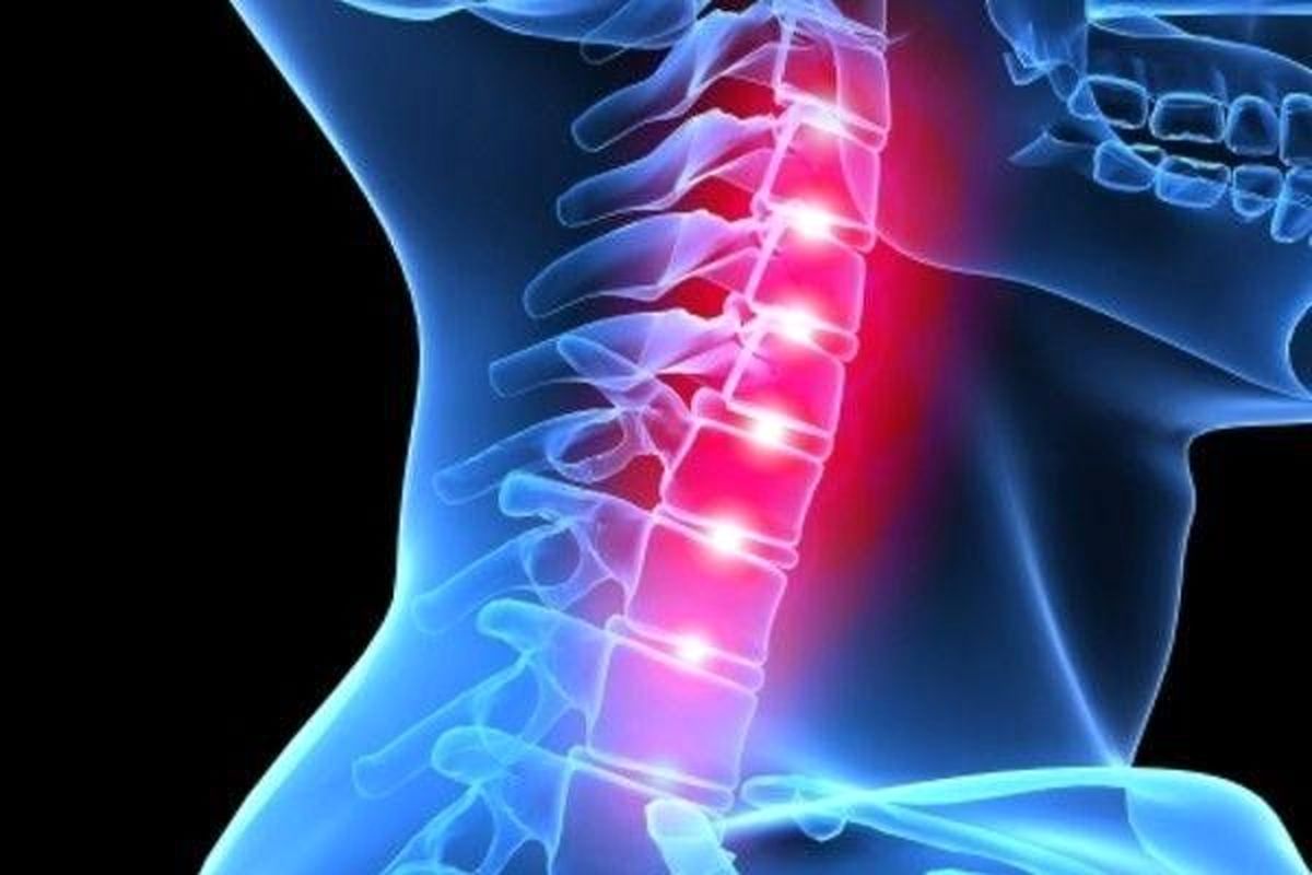 علائم فتق دیسک گردن چیست و چگونه درمان می شود؟