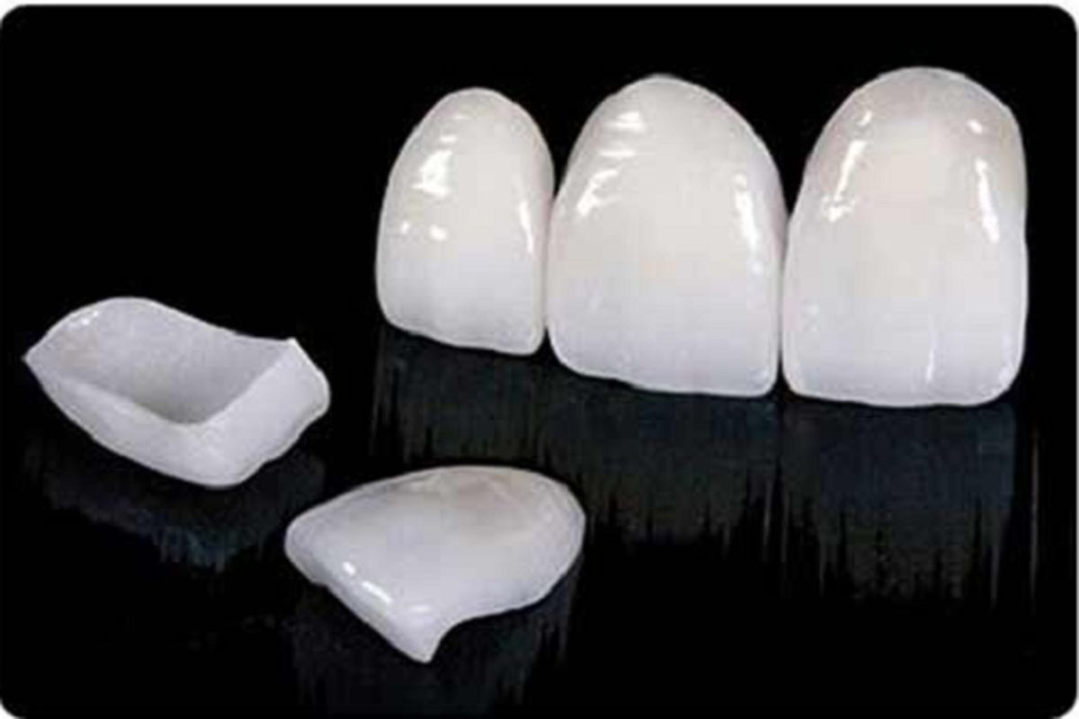 کشف ۳ هزار عدد کامپوزیت دندانپزشکی غیر مجاز به ارزش ۶ میلیارد ریال در ارومیه