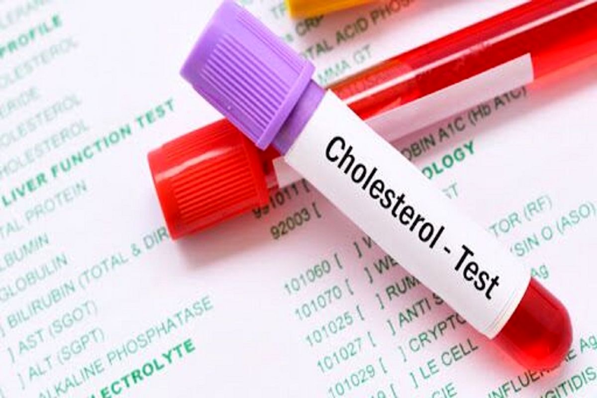 تفاوت های کلسترول و تری گلیسیرید چیست؟