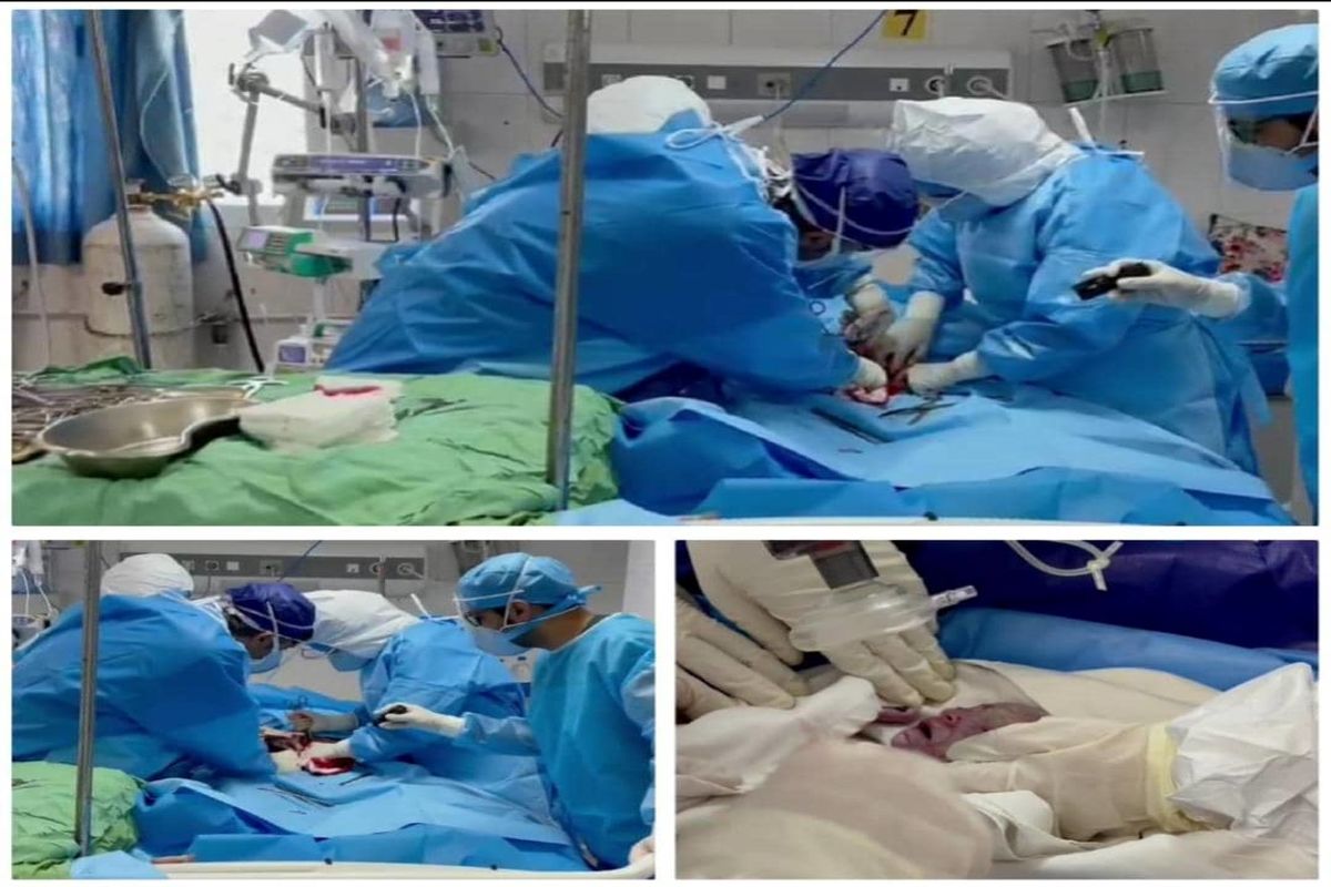 نوزاد مادر مبتلا به کووید۱۹ در بخش مراقبت‌های ویژه بیمارستان شهید محمدی متولد شد