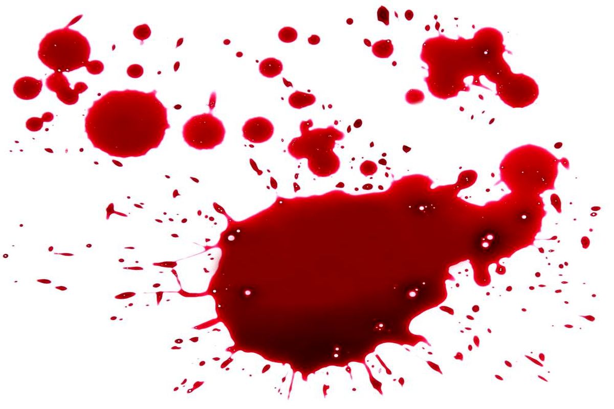 درگیری خونین ۲ پزشک متخصص در نیشابور/ پزشک ضارب خودکشی کرد