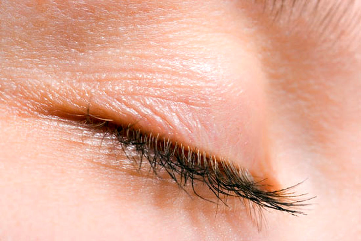دلیل پریدن پلک چشم چیست؟
