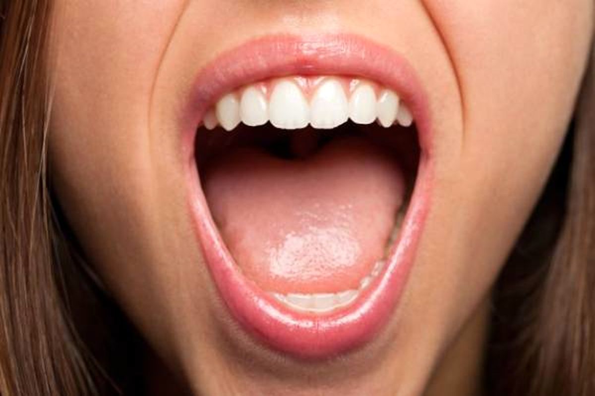 علل ایجاد بوی دهان چیست؟