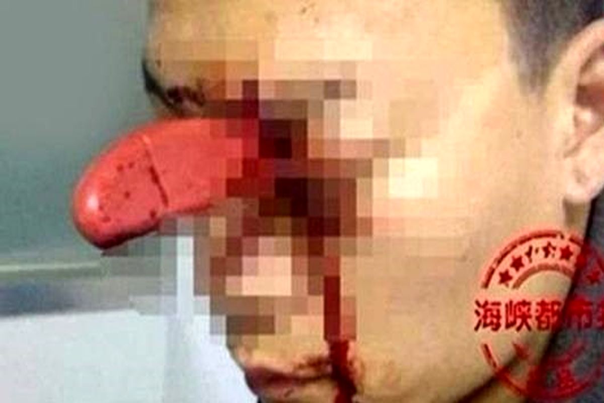 زن دیوانه چاقو را در چشم همسرش فرو کرد! + عکس