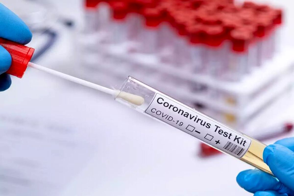آیا واقعا لازم است پس از واکسن کرونا زدن آزمایش آنتی‌بادی انجام دهم؟
