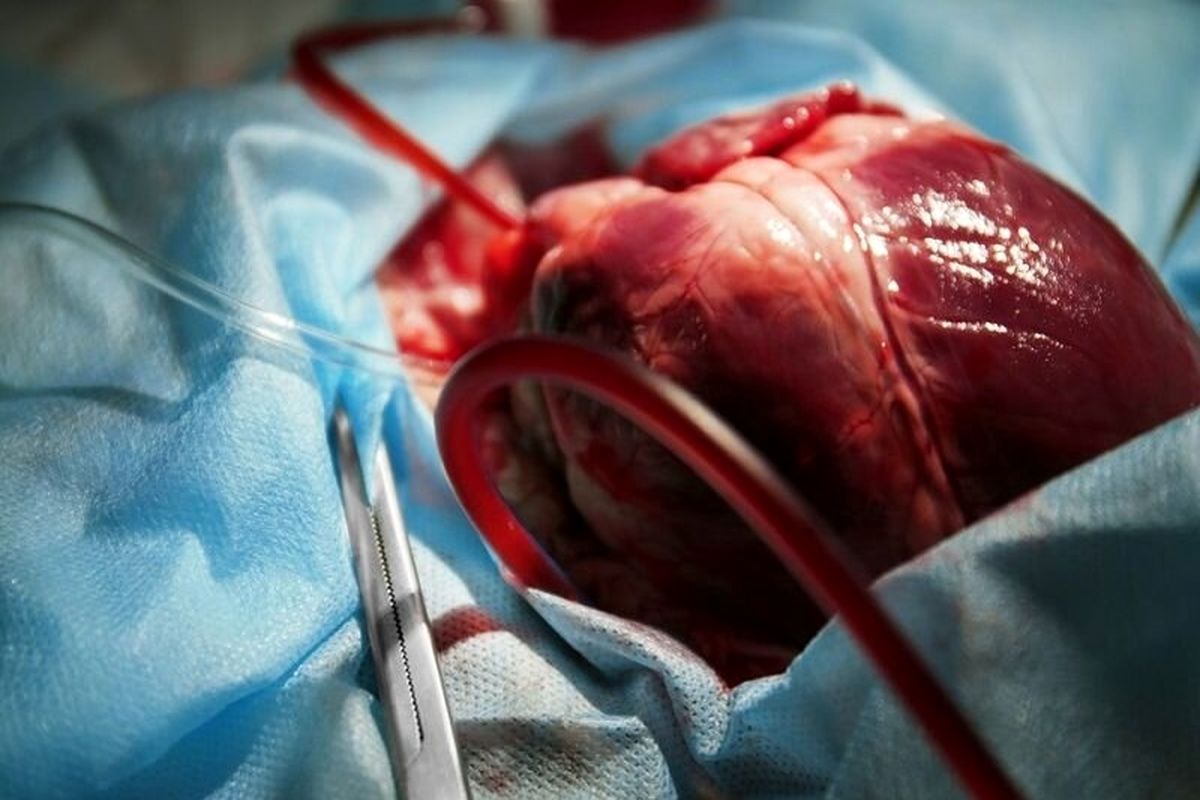 عمل جراحی قلب باز در بیمارستان امام سجاد(ع) شهر یاسوج انجام می‌شود