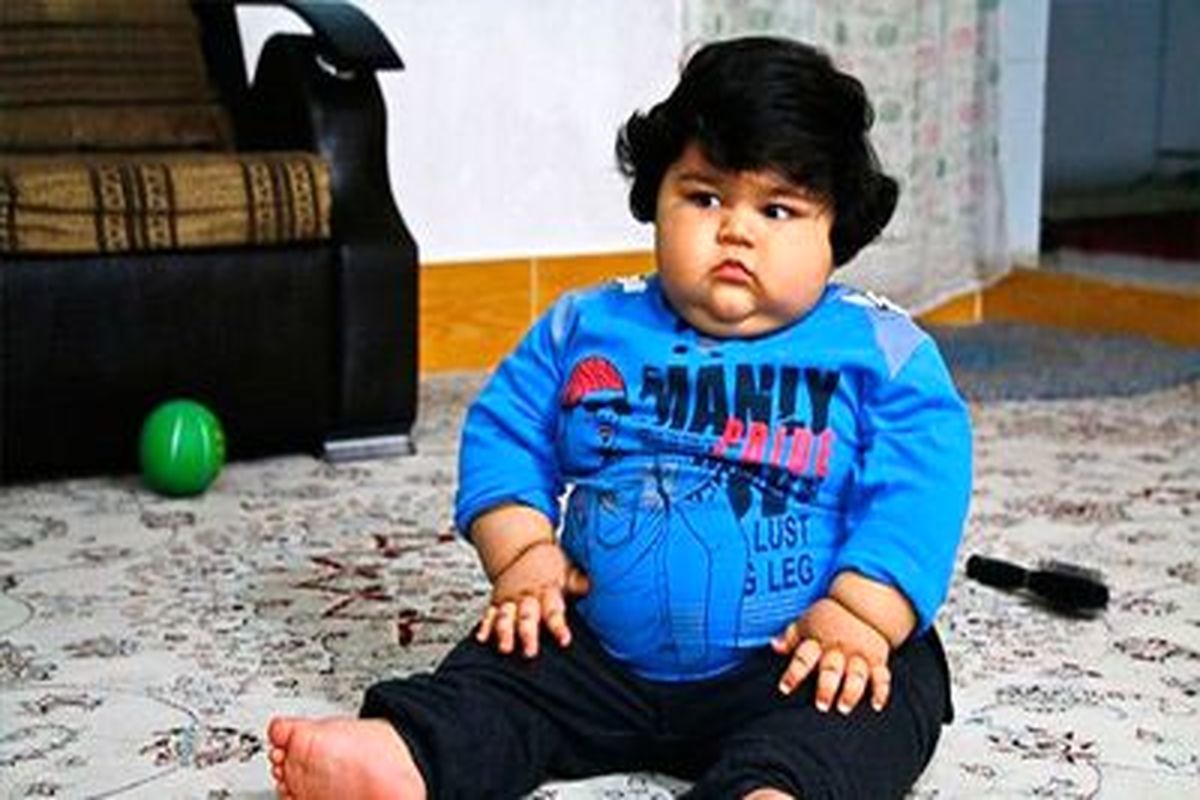 رئیس پژوهشگاه غدد: ۲۰ درصد کودکان شرق تهران چاق هستند