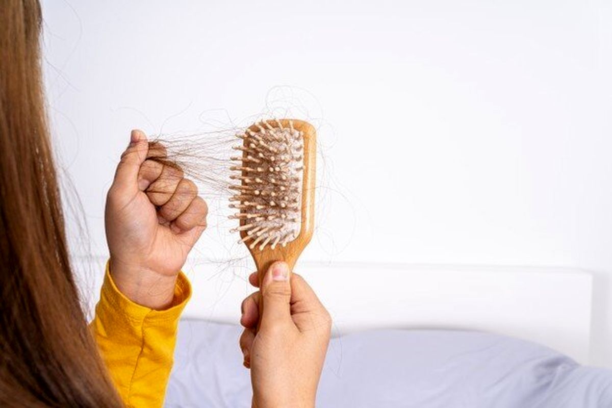 تاثیر یک ماده غذایی محبوب بر ریزش مو