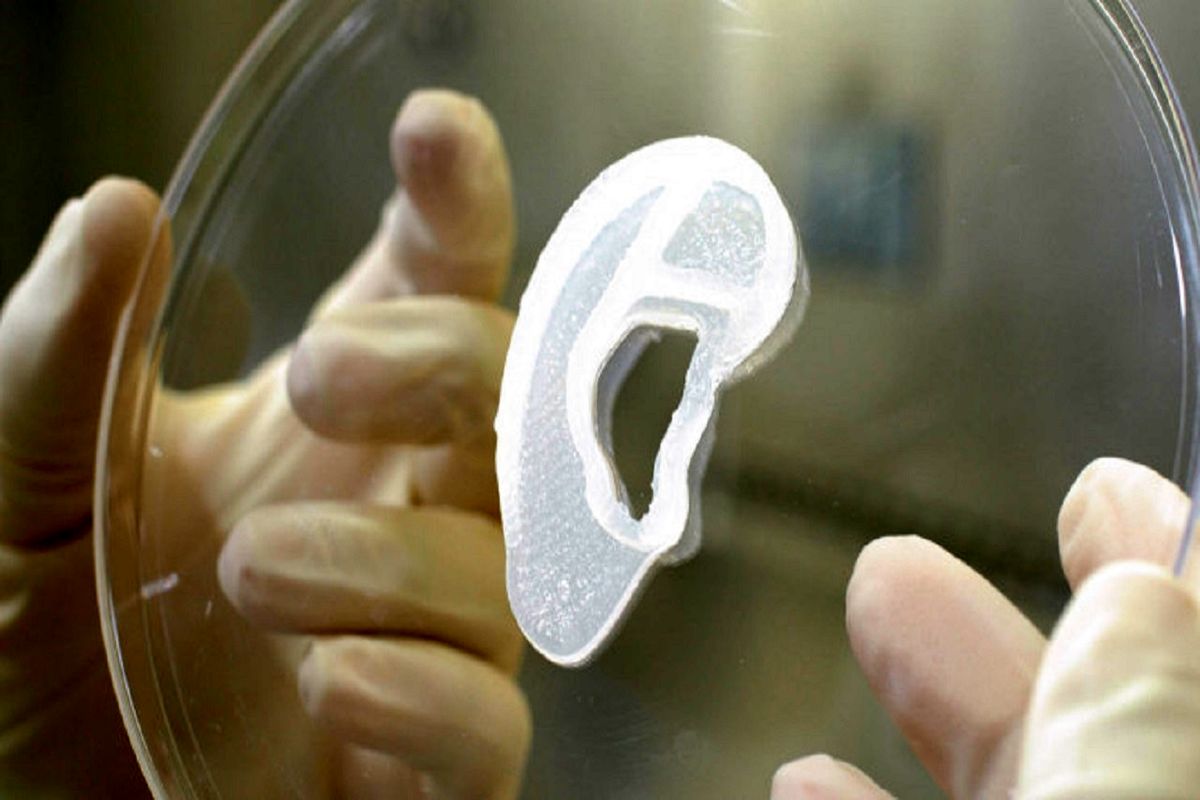 پیوند گوش سه بعدی برای انسان انجام شد