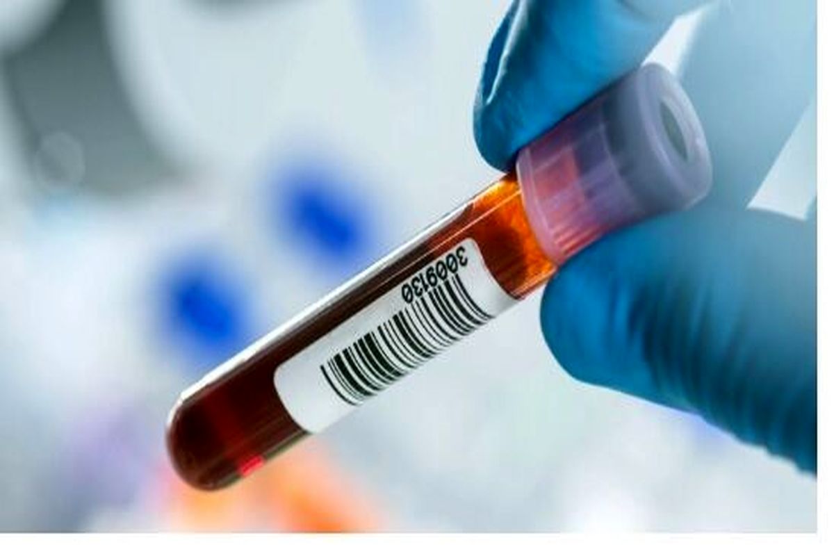 کاربرد جدید آزمایش خون در تشخیص سرطان