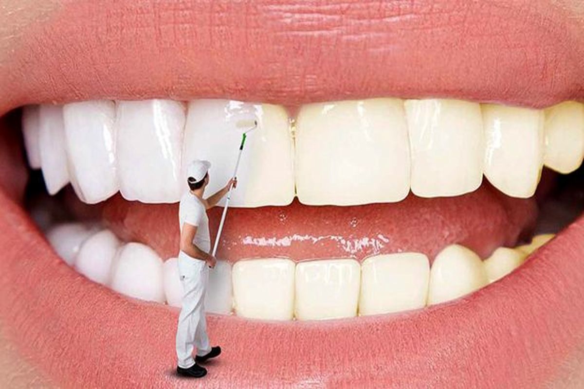 این روش های خانگی باعث سفید شدن دندان ها می شوند!