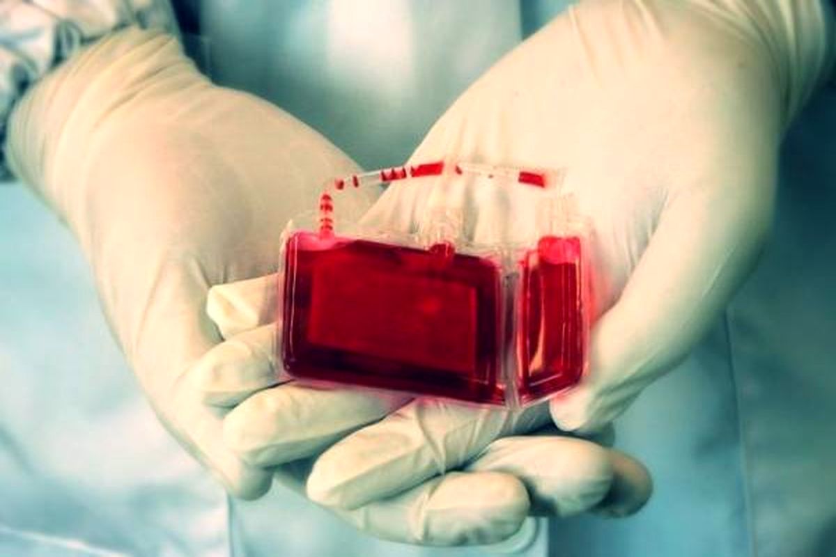 ذخیره سازی ماهانه ۵۰ تا ۶۰ نمونه خون بند ناف نوزادان در البرز