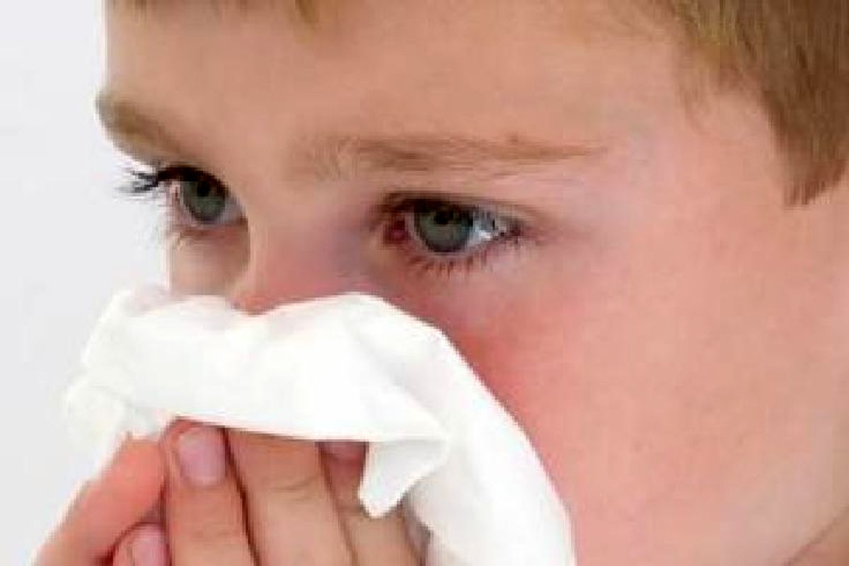 شایع ترین علل خونریزی بینی در کودکان چیست؟